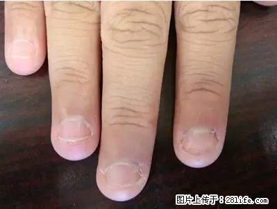 剪指甲、挖耳屎,这些日常小动作竟隐藏大危害! - 梧州生活资讯 - 梧州28生活网 wuzhou.28life.net